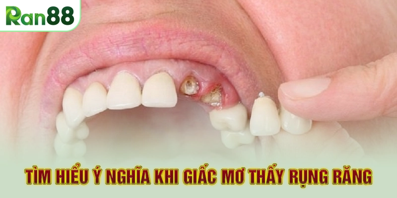 Tìm Hiểu Ý Nghĩa Khi Giấc Mơ Thấy Rụng Răng