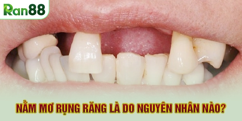 Nằm mơ rụng răng là do nguyên nhân nào?